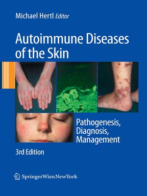 cover image of Autoimmune Diseases of the Skin